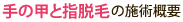 手の甲と指脱毛の施術概要